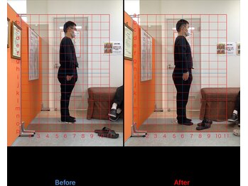 ゼロヒャク整骨院(ZERO100整骨院)/猫背矯正×骨盤矯正