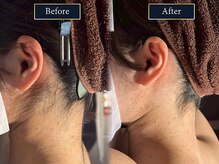 グラスト(Grast)/写真盛れ確定★うなじ革命