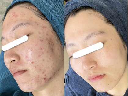 ソリッジ肌管理室の写真