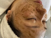 アリクシー(ALIXSY)の雰囲気（ハーブピーリングで【くすみ肌荒れニキビ】改善し究極の卵肌へ♪）
