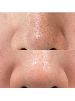 メガミノチカラ/【セルフエステ】フェイシャル