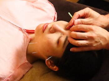 鍼灸整体院 赤坂養美(Akasaka YOBI)の写真/美容鍼小顔のスペシャリストのベテランスタッフが在籍☆丁寧な施術でむくみを解消し理想の小顔に導きます◎