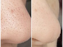 ニコ アンド キャンディー(Nico.&Candy)/取れた汚れもしっかり確認！