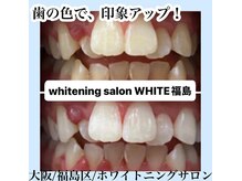 ホワイトニングサロン ホワイト(WHITE)/セルフホワイトニング/大阪/福島