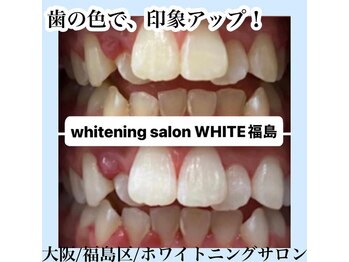 ホワイトニングサロン ホワイト(WHITE)/セルフホワイトニング/大阪/福島