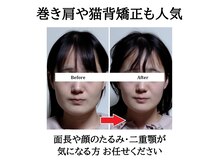 みなとの雰囲気（巻き肩や猫背矯正も人気♪面長や顔のたるみ改善にも◎）