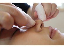 ベイビースキン(Baby skin)の雰囲気（いちご鼻から解放！【tete式】毛穴エクストラクション）