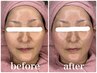 この春、肌が主役！【WAX脱毛】で輝くスベスベ肌へ！