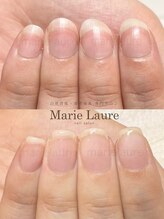 マリーロール 梅田店(Marie Laure)/深爪矯正/自爪育成/ネイルケア