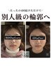 《ご新規様限定》【お試しに・左右差改善◎】小顔矯正＋リンパケア　