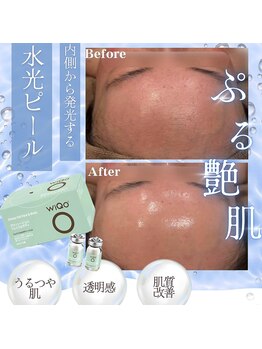 オンユ(ON’U)/wiQo水光ピール◎リピート率No.1