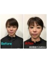 ユメカ 日の出院(YUMEKA)/小顔矯正でリフトアップ！