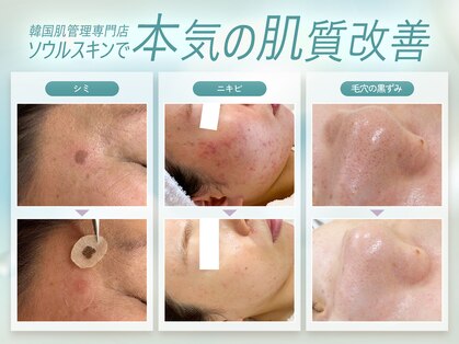 ソウルスキンの写真