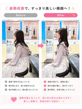 小林整骨院 天六の写真/猫背・巻き肩を整えて、疲れにくいキレイな姿勢へ