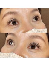 ラヴィズム アイラッシュ アンド ネイル (LUVISM)/ぱっちり★パリジェンヌ