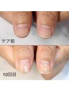 形改善【ネイルケアコース】