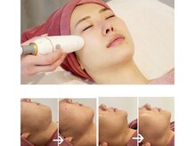 ジーン(Gene)の雰囲気（最新機器で小顔に!結果に重視した優良認定店です!）