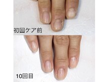 アイネイルズ(Ai nails)