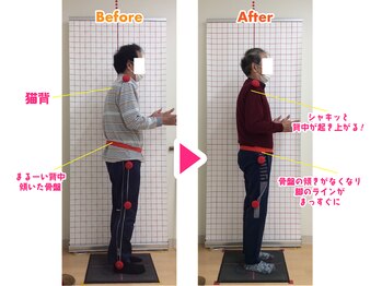 藤接骨院 浜松東院/杖なしで歩けるように