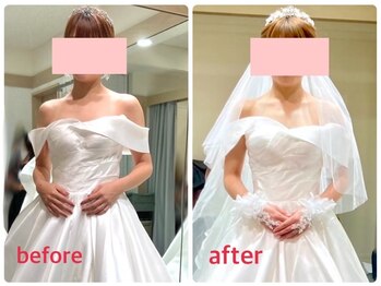 イチ(ichi)/ブライダルケア