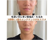 ビーボヌール(be-bonheur)の雰囲気（たるみケア/フェイスラインや目元スッキリ肌もキレイに）