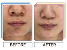 ストラッシュ 大宮店(STLASSH)/【ストラッシュ】お客様の施術例