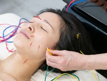マグノリアの写真/大好評！【輪郭からリフトアップの最強施術】結果で選ぶなら「ツボ小顔術」×「パルス美容鍼」毛穴にも◎