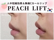 ヘティ バイ ソウル 中目黒(HETIY by Seoul)/人中短縮効果も..☆