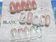 ブラン(BLANC)の写真/シンプルコース/トレンドコース/カラー変更可能◎豊富なデザインとリーズナブルな価格で毎月通いたくなる♪
