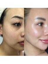 ポーデベロア(Peau des velours)&nbsp;【結果と 信頼】