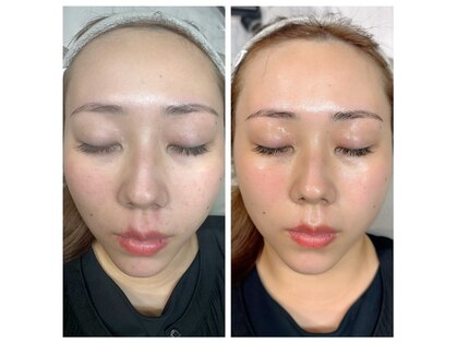 ワン(ONE.)の写真