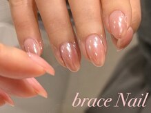 ブレスネイル(brace Nail)