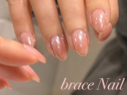 ブレスネイル(brace Nail)の写真
