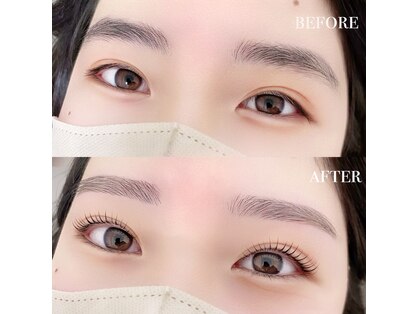 エードットアイ(A.eye)の写真