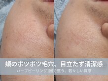 ラシック 加古川店(La chic.)/30代からの老け見え肌を集中ケア
