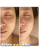 フルールドソレイユ(Fleur de Soleil)/むくみ・歪み解消×小顔矯正