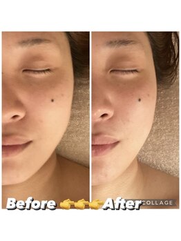 フルールドソレイユ(Fleur de Soleil)/むくみ・歪み解消×小顔矯正