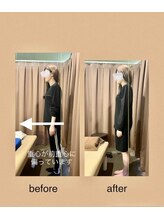 アイリー(Irie)/骨格矯正