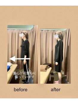 アイリー(Irie)/骨格矯正