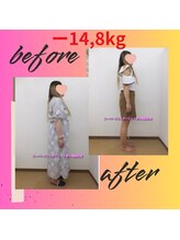 スーパースリムダイエット茅ヶ崎 茅ヶ崎整体院/4ヵ月－14,8ｋｇ減ダイエット♪