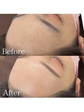 ブラン 磐田店(Blanc)/おでこWAX