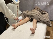 ビモアス(bimous)