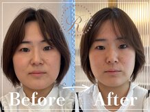 R-1ビューティーサロン 表参道/Before＆After