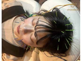 チョコバリ 渋谷店(chocobari)/小顔×リフトアップ(美容鍼)20代