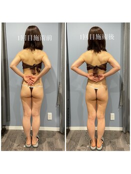 サロンドフィル(Salon de fil)/背中の不調