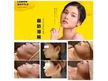 ベルシア(BELCIA)の雰囲気（   専門業界並！脂肪分解でスッキリ小顔【1回～2回でこの変化】）