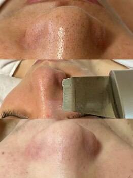 心地(KOKOCHI)/鼻黒ずみ気になる