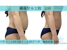 リメイクビューティークリニック(REMAKE BEAUTY CLINIC)/ダイエットはお任せください