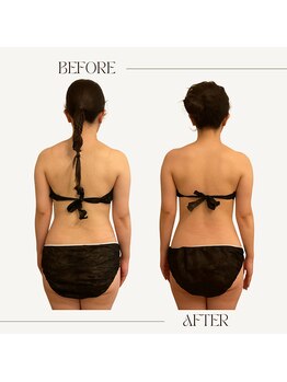 ファミーユ 名古屋店/【ブライダルケア】上半身集中