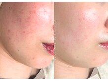 ウォナ(WONA)/【お客様症例】